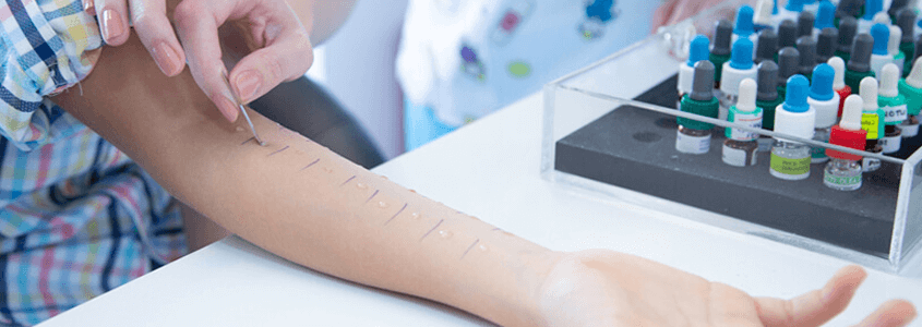 Polen Alerjisi Teşhisi Nasıl Konulur?