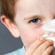 Polen Alerjisinden Jel İle Korunma Yöntemi Nasıldır?